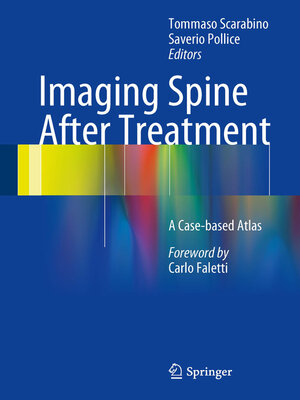 cover image of Imaging Spine After Treatment